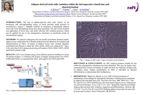 adipose-derived-stem-cells