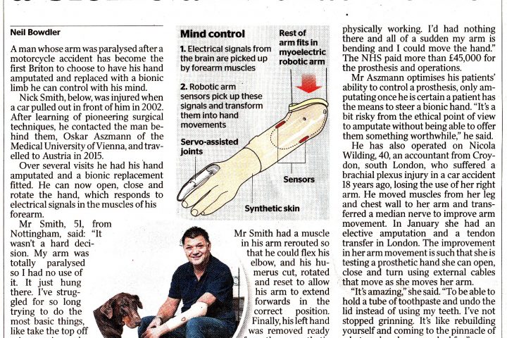 RAFT trustee quoted in The Times for article on new bionic limb technology